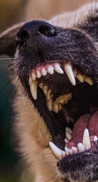 Dog Bite Injuries